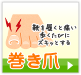 靴を履くと痛い歩くたびにズキッとする